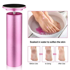 Electric Foot Callus