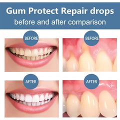 Teeth Whitening Essence